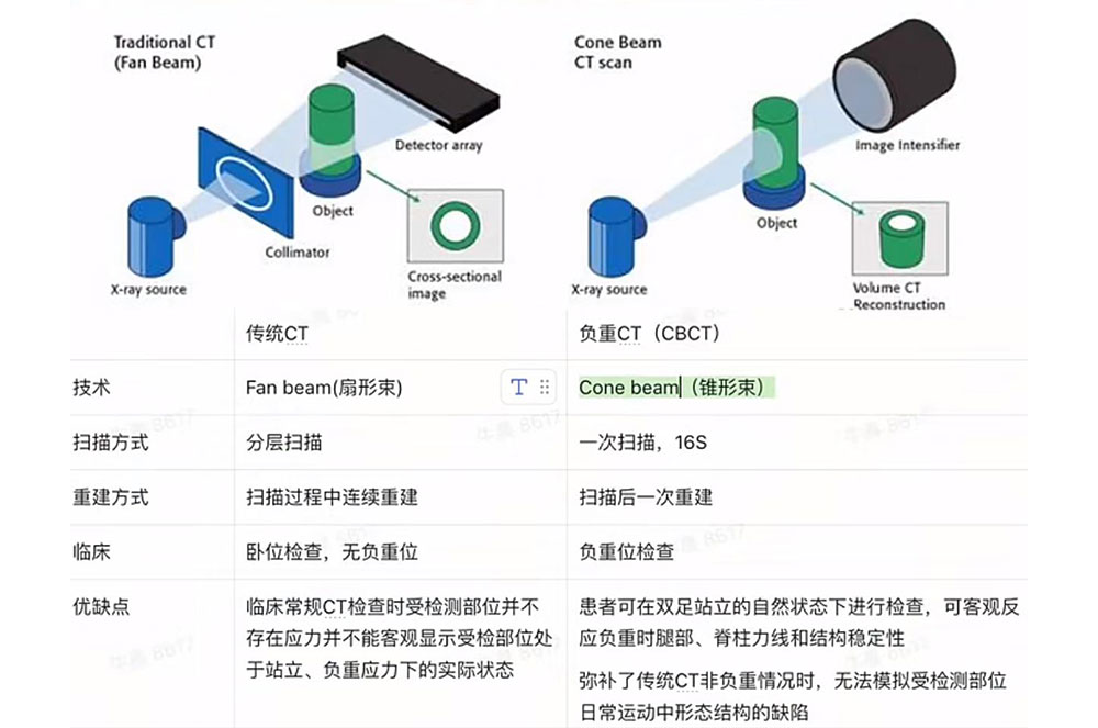 负重CT和传统CT有何不同?